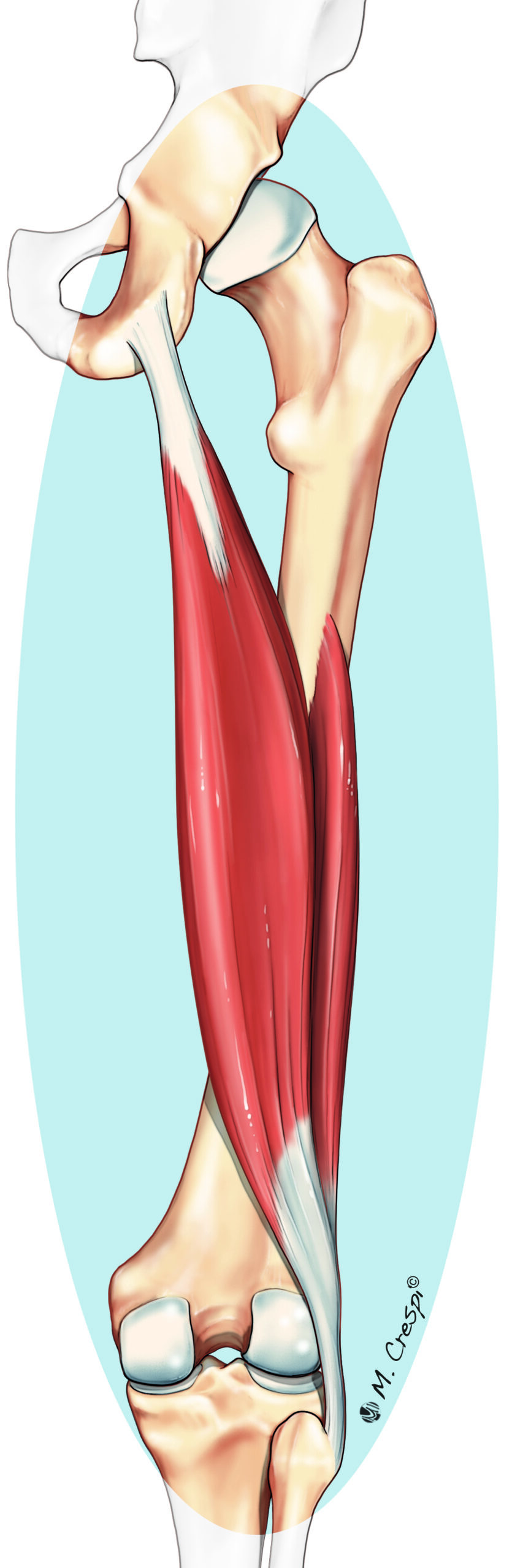 Proximal Hamstring Injuries Orthosport Victoria