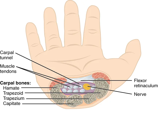 Carpal Tunnel Syndrome